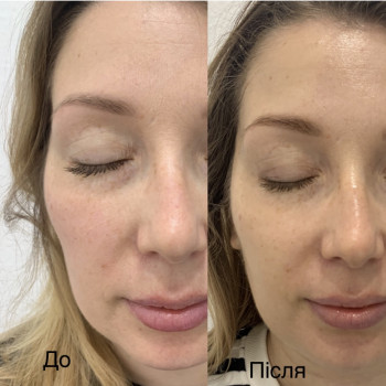 Галина Пошивак, Трускавець Фото - 6