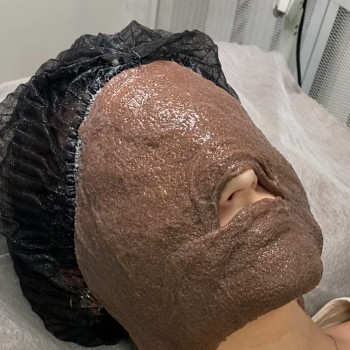 Маски за типом шкіри
                    Врач-косметолог Филипп Киев