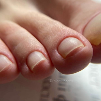 Жанна Ковальська, Буча Фото - 10