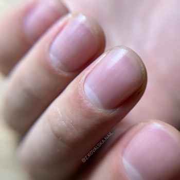 Жанна Ковальська, Буча Фото - 11