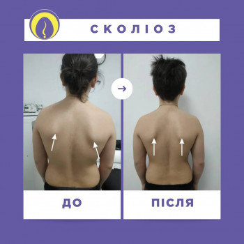 Медицинский центр доктора Бубновского, Ивано-Франковск Фото - 5