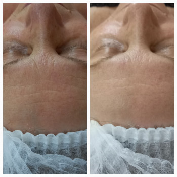 Людмила Патек, Ужгород Фото - 13