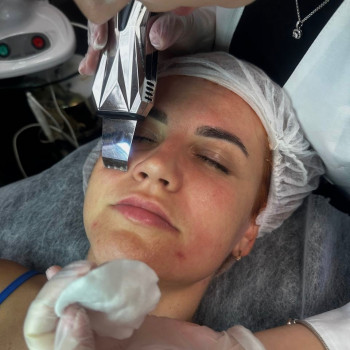 Даніела Туряниця, Мукачево Фото - 5