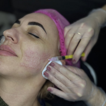 Даніела Туряниця, Мукачево Фото - 14