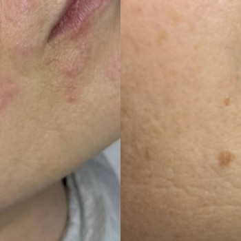 Оксана Cosmetology, Ірпінь Фото - 5