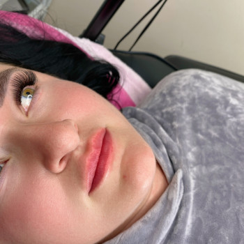 Контурна пластика губ