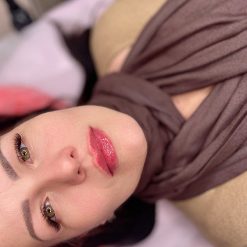 Контурна пластика губ