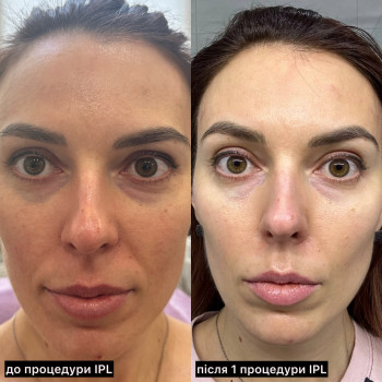 Анна Литовченко, Одесса Фото - 20