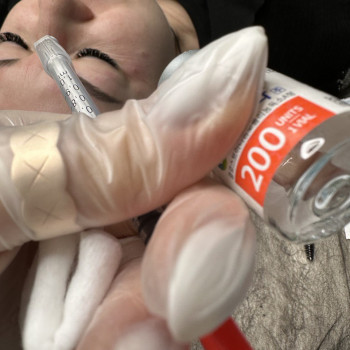 БОТОКС
                    Навчальний центр Hollywood Beauty Вінниця