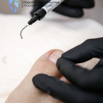 титанова нитка