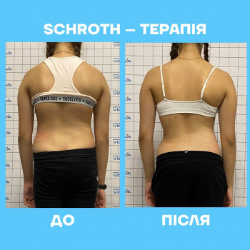 Фото з портфоліо клініки Vidnova (медичний центр, Суми)