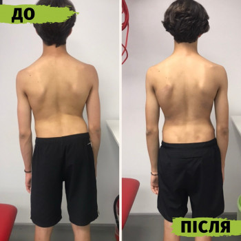 Інститут вертебрології та реабілітації, Ивано-Франковск Фото - 5