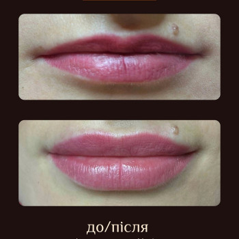 Al's Hair Clinic, Ивано-Франковск Фото - 5