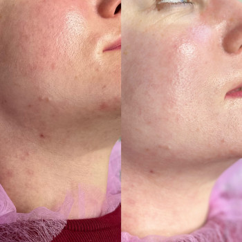 Вікторія Науменко, Одеса Фото - 3