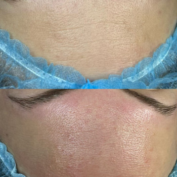 Вікторія Науменко, Одеса Фото - 4