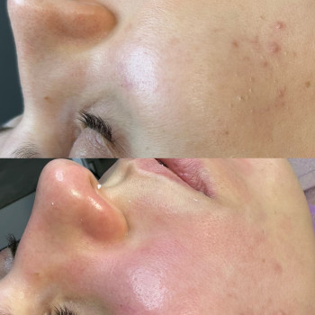 Вікторія Науменко, Одеса Фото - 6