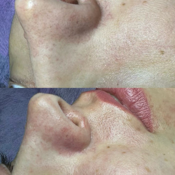 Вікторія Науменко, Одеса Фото - 8