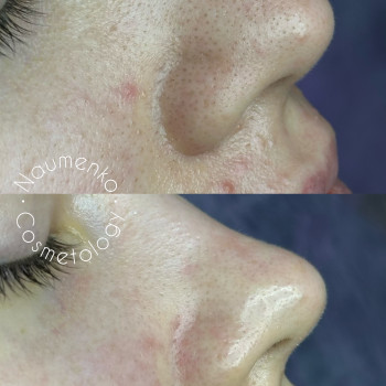 Вікторія Науменко, Одеса Фото - 9