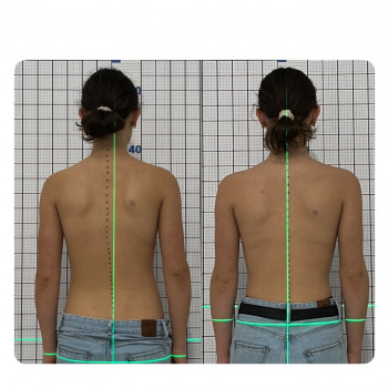 Центр реабилитации и восстановления, Тернополь Фото - 5