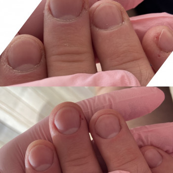 Наталя Король, Ірпінь Фото - 22