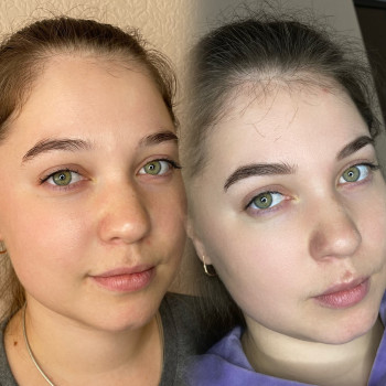 Анна Краслянська, Полтава Фото - 26