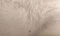 Електроепіляція Электролог Людмила Вишнёвое