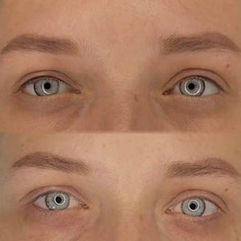 Міжвійка
                    Майстер перманентного макіяжу Алиса Дніпро