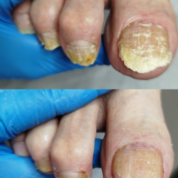 Анна Башмакова, Одеса Фото - 1