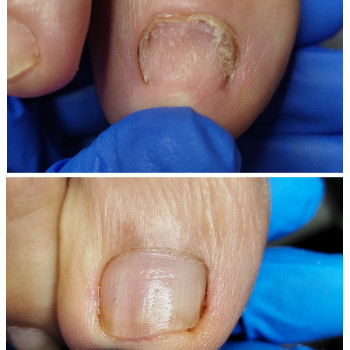 Анна Башмакова, Одеса Фото - 3