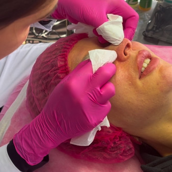 Механічна чистка — це метод глибокого очищення шкіри, при якому вручну або за допомогою інструментів...