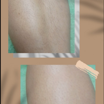 Анна Форкун, Хмельницкий Фото - 10