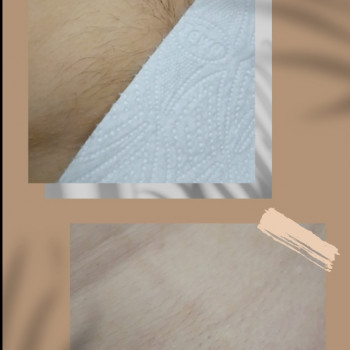 Анна Форкун, Хмельницкий Фото - 11