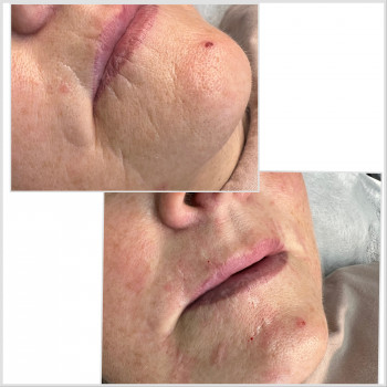 Олена Смульська, Хмельницький Фото - 8