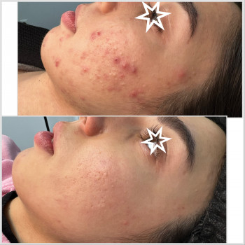 Олена Смульська, Хмельницький Фото - 10