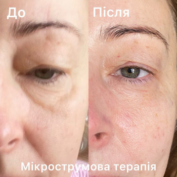 Мікрострумова терапія

1 сеанс