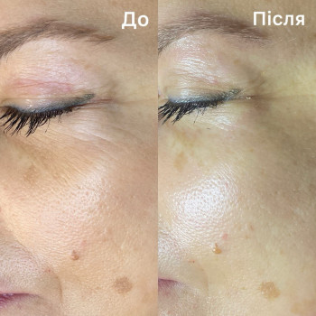 Біоензимна терапія

1 сеанс