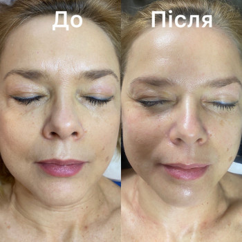 Біоензимна терапія

1 сеанс