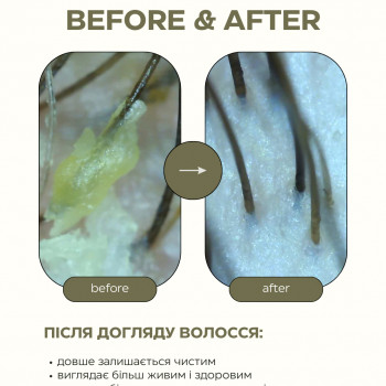 Ультразвуковий пілінг шкіри голови: детокс і оновлення для вашої шкіри голови!
                    Перукар Екатерина Київ