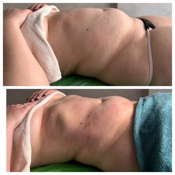 Lipokiller
                    Массажист Елена Одесса