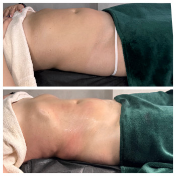 Lipokiller
                    Массажист Елена Одесса