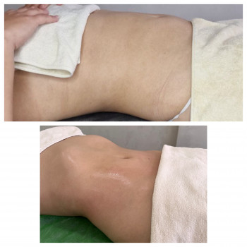 Lipokiller
                    Массажист Елена Одесса