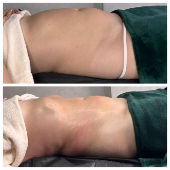 Lipokiller
                    Массажист Елена Одесса