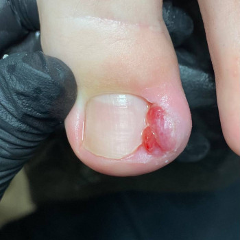 Консультація подолога
                    Ногтевая студия STERILE NAILS Киев