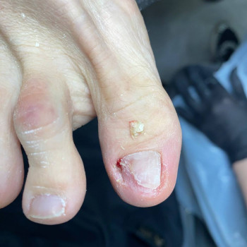 Консультація подолога
                    Ногтевая студия STERILE NAILS Киев