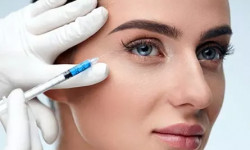 Ботулінотерапія "Лоб" Косметологический центр Perfect Skin Киев