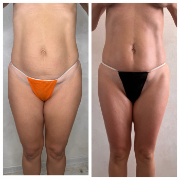 Олена Захарченко, Одеса Фото - 5