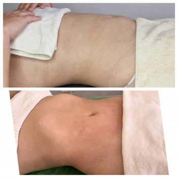 Олена Захарченко, Одеса Фото - 6