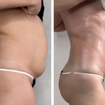 Олена Захарченко, Одеса Фото - 8