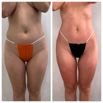 Олена Захарченко, Одеса Фото - 9