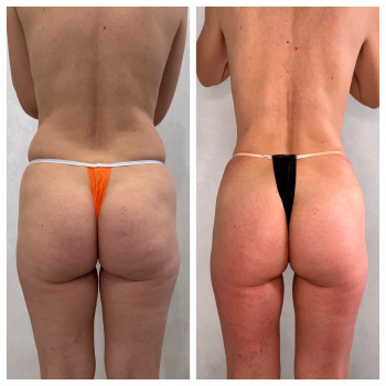 Олена Захарченко, Одеса Фото - 10